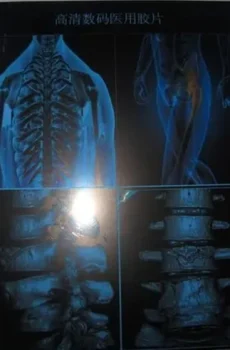 DT2B5B X-ray Film for Medical Inspection, Military, Welding Industry, Aerospace, etc.